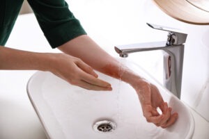 Boca Raton Burn Injury Lawyer