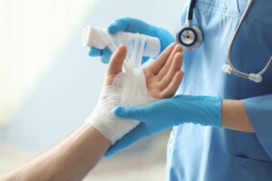 Naples Burn Injury Lawyer