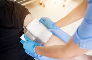 Massachusetts Burn Injury Lawyer
